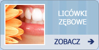 Licówki