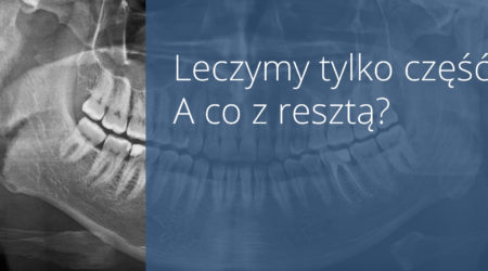 Dentysta na&nbsp;raty