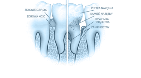 Periodontolog
