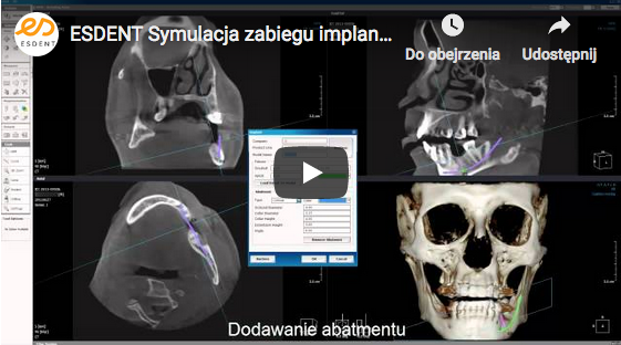Implanty zębów Wrocław