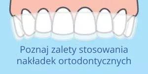 nakładki ortodontyczne (1)